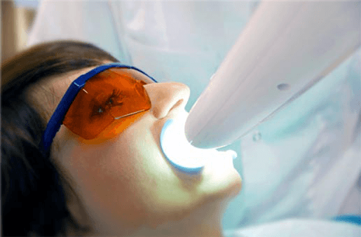 Understanding the Causes of Teeth Sensitivity Folkestone
