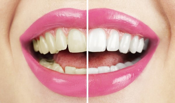 What Early Signs of Oral Cancer Should You Never Ignore Folkestone?