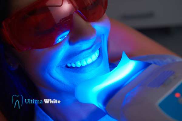 Professional Teeth Whitening Options Folkestone