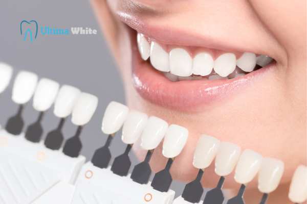 How to Maximise the Results of Your Laser Teeth Whitening Treatment Folkestone
