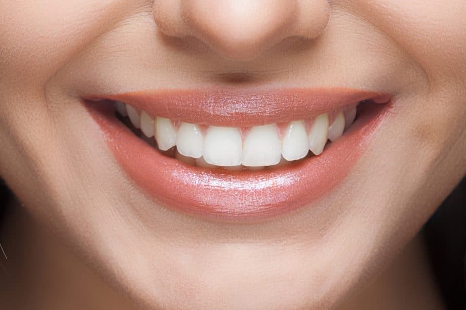 Beyond Whitening: How Your Daily Diet Affects Long-Term Smile Brightness Folkestone