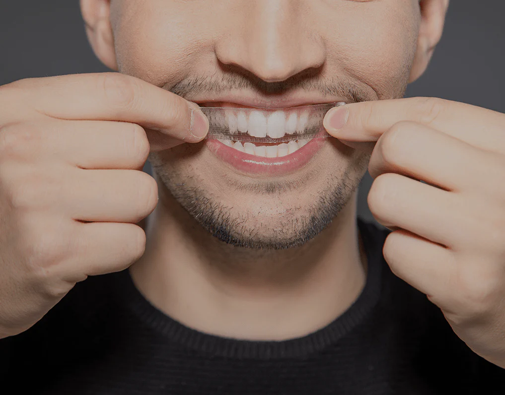 How Are Invisible Aligners Changing Orthodontic Treatments Folkestone?