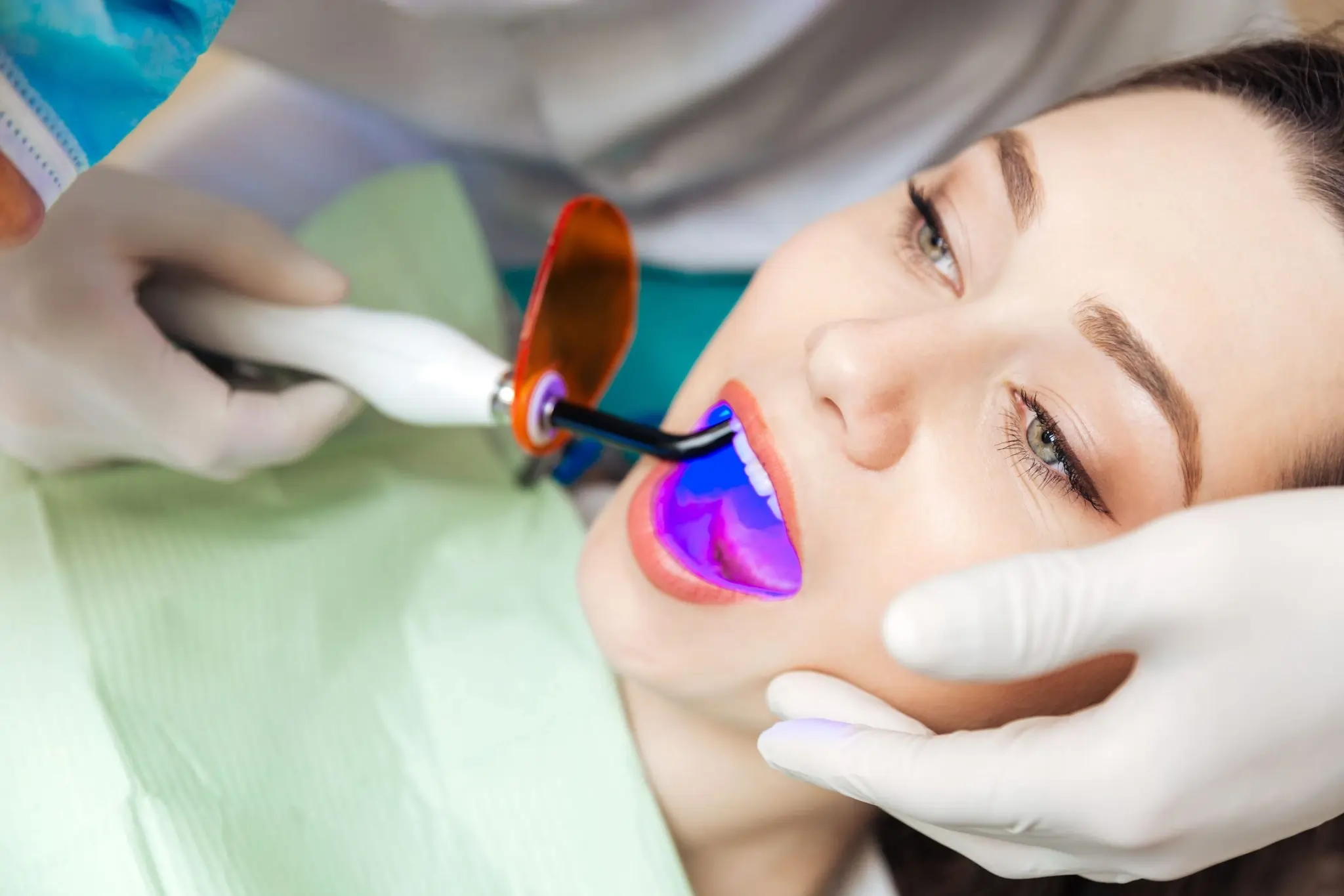 Common Risks of Whitening Without Expert Dental Guidance Folkestone