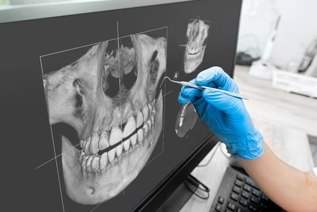 Key Benefits of 3D Printing for Patients and Dentists Folkestone