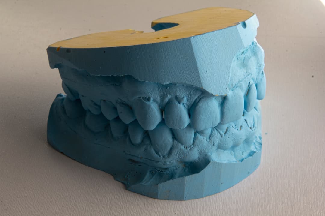How Do Dental Implants Improve Jawbone Health and Oral Function Folkestone?