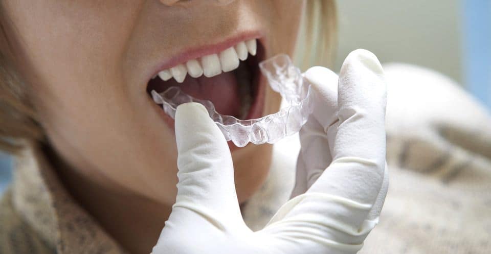Can Bruxism Affect Your Sleep Quality Folkestone