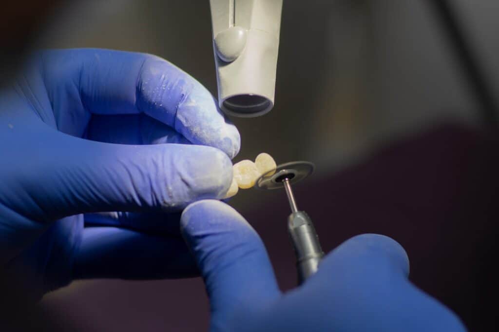 Customised Dental Solutions: Crowns, Aligners, and Implants Folkestone