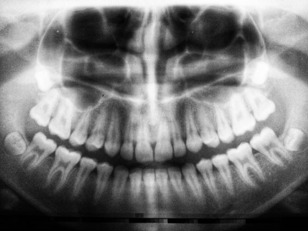 The Future of 3D Printing in Oral Healthcare Folkestone