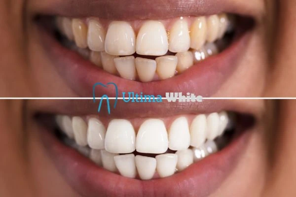 Long lasting results from Ultima White Folkestone